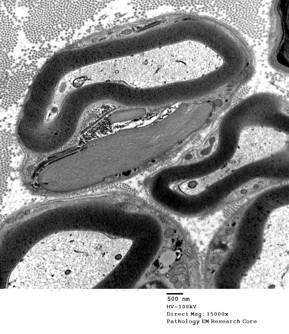 4A Pi Granules (Case 4) EM 108 - Copy