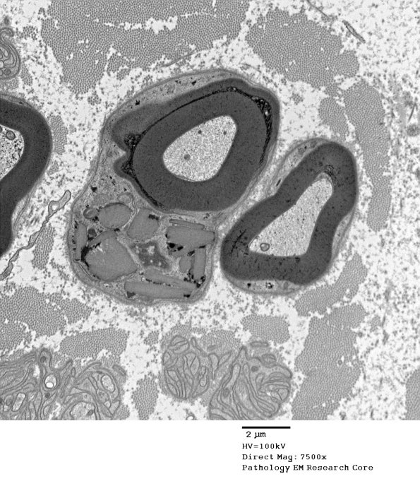 4B1 PG (Case 4) EM 123 - Copy