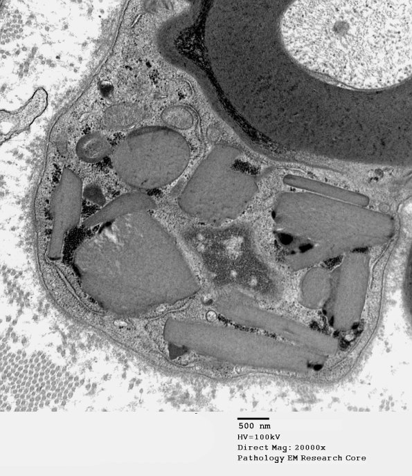 4B2 PG (Case 4) EM 124 - Copy