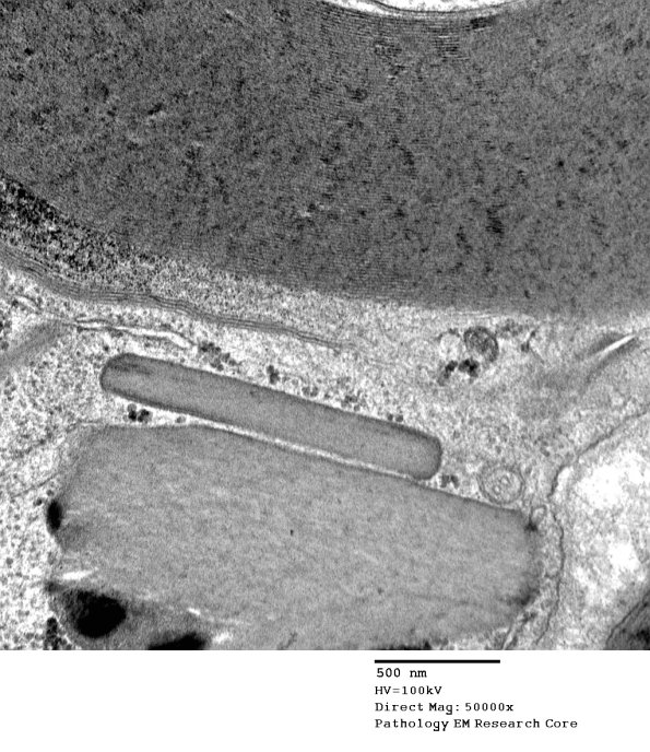 4B3 PG (Case 4) EM 125 - Copy