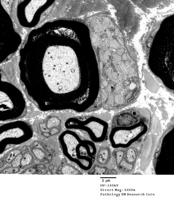 7A1 Normal Nerve (Case 7) new_042A - Copy