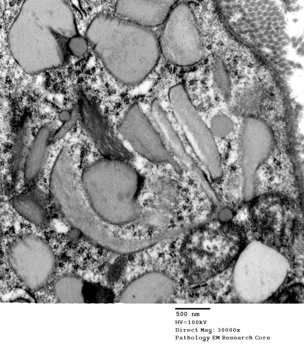 7A2 Normal Nerve (Case 7) new_044A - Copy
