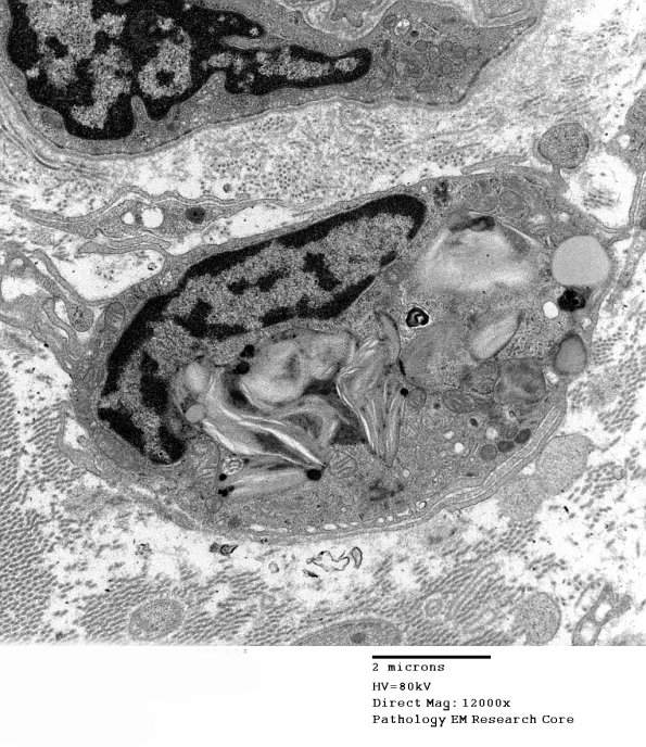 8A1 (Case 8) Nerve_006 - Copy