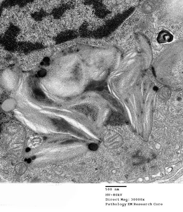 8A2 (Case 8) EM 007 - Copy
