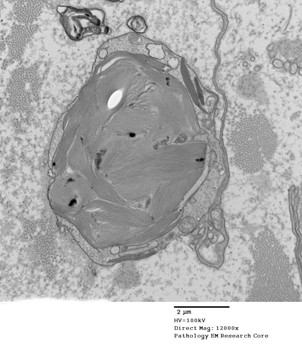 9A1 (Case 9) EM 023 - Copy