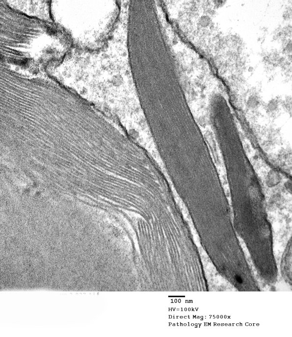 9A2 (Case 9) EM 027 - Copy