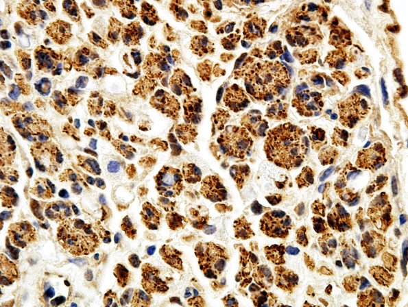 1B1 Regeneration NF (Case 1) aA