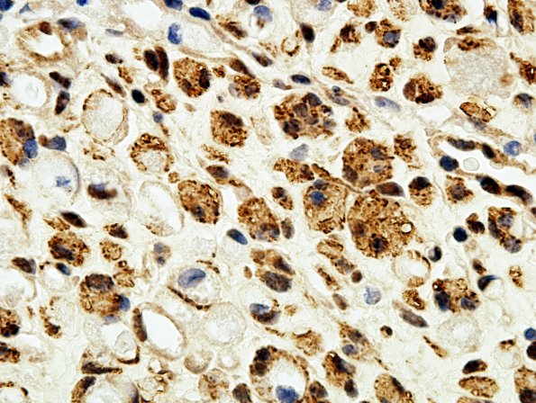 1B2 Regeneration NF (Case 1) A