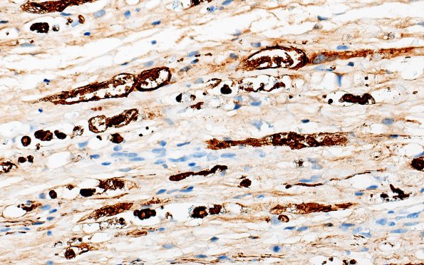 7C3 Ovoids (Case 7) NF 40X 2