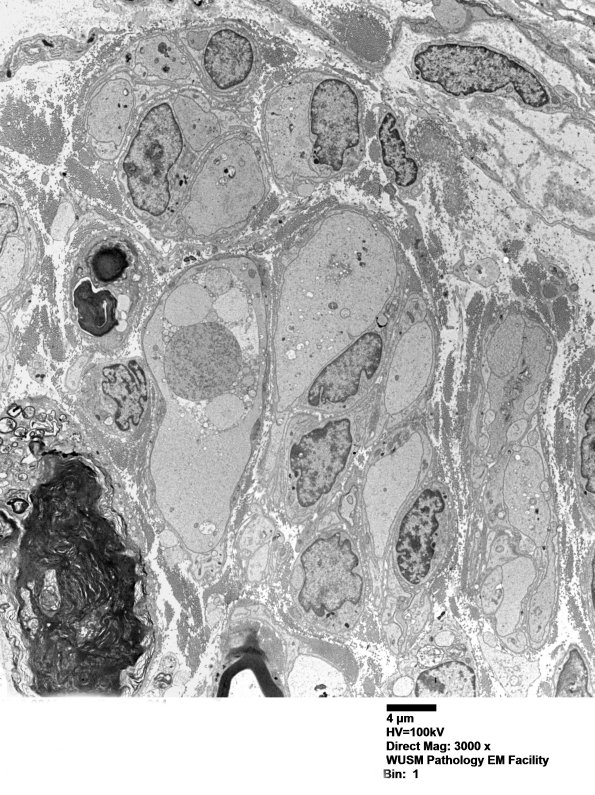 12B1 W18-904A Irving E nerve_014 - Copy