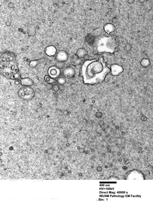 12B3 W18-904A Irving E nerve_010 - Copy