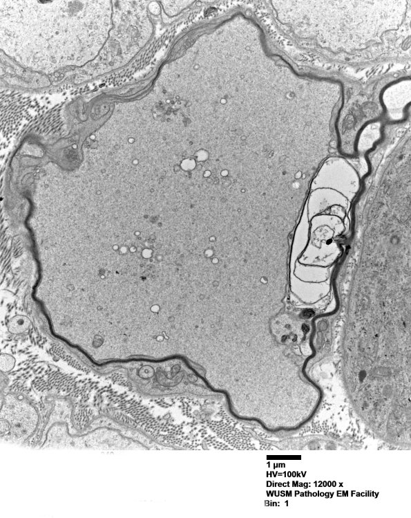 12B5 W18-904A Irving E nerve_040 - Copy