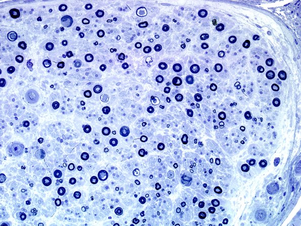 21A1 Small MF loss (Case 21) Plastic 1.jpg