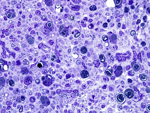 28A1 Mouse Constriction Injury, distal sciatic (R13-233) Plastic 100X 1.jpg