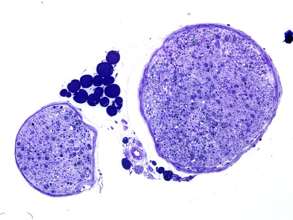 28A2 Mouse Constriction Injury, distal sciatic (R13-233) Plastic 20X.jpg
