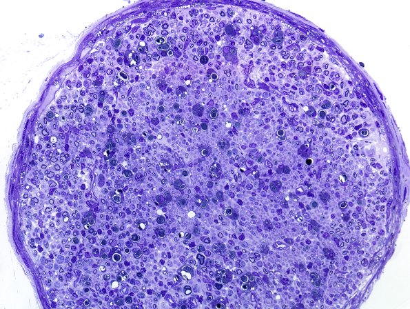 28A3 Mouse Constriction Injury, distal sciatic (R13-233) Plastic 40X.jpg