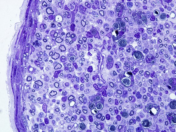 28A4 Mouse Constriction Injury, distal sciatic (R13-233) Plastic 100X 3.jpg