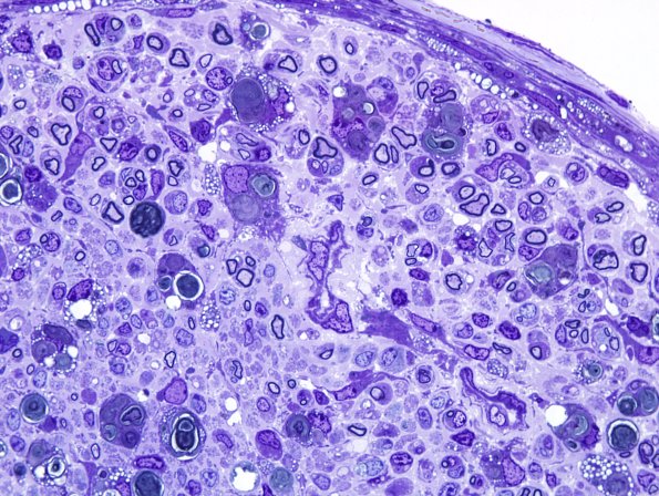 28A5 Mouse Constriction Injury, distal sciatic (R13-233) Plastic 100X 4.jpg