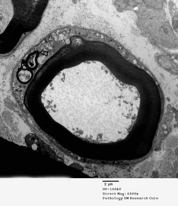 1C1 S08-24688 (Case 3) EM - Copy