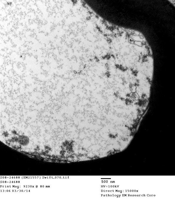 1C2 S08-24688 (Case 3) EM 070 - Copy