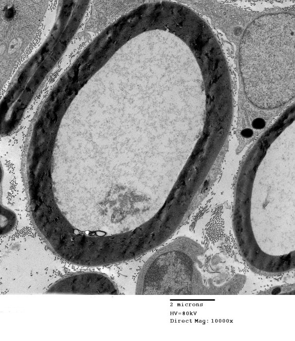 1F1 AMPK KO Mouse Degen Axons (Case 6) EM 015.jpg
