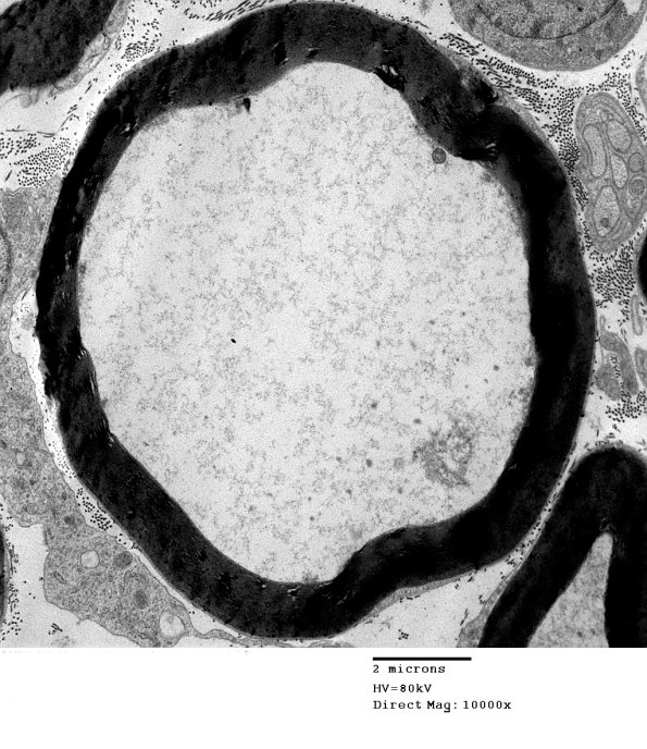 1F2 AMPK KO Mouse Degen Axons (Case 6) EM 011.jpg