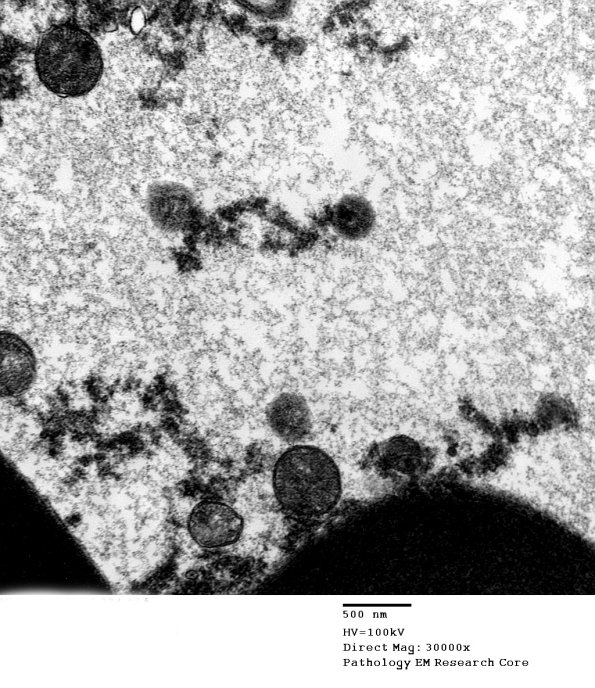 1G2 (Case 7) EM 034 - Copy