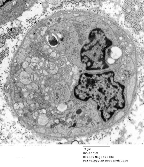 2C1 (Case 10) EM 048 - Copy