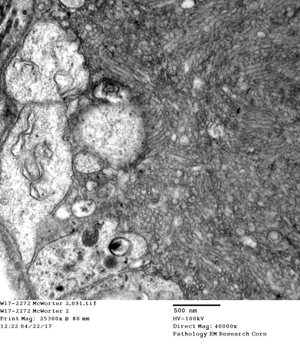 2C10 (Case 10) EM 091 - Copy