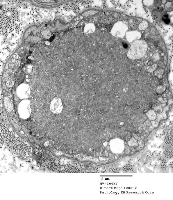2C11 (Case 10) EM 135 - Copy