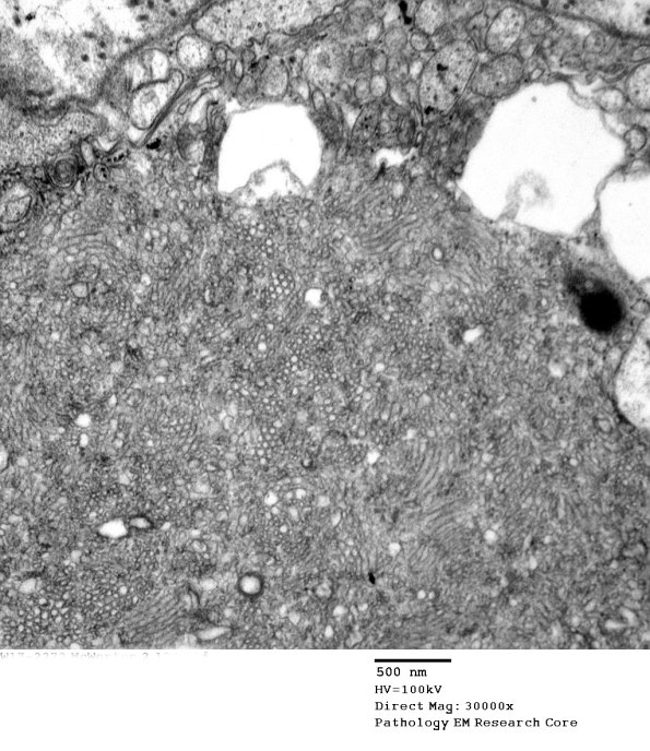 2C12 (Case 10) EM 136 - Copy