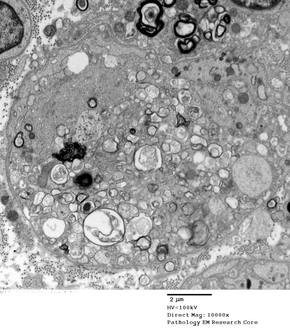 2C13 (Case 10) EM 137 - Copy