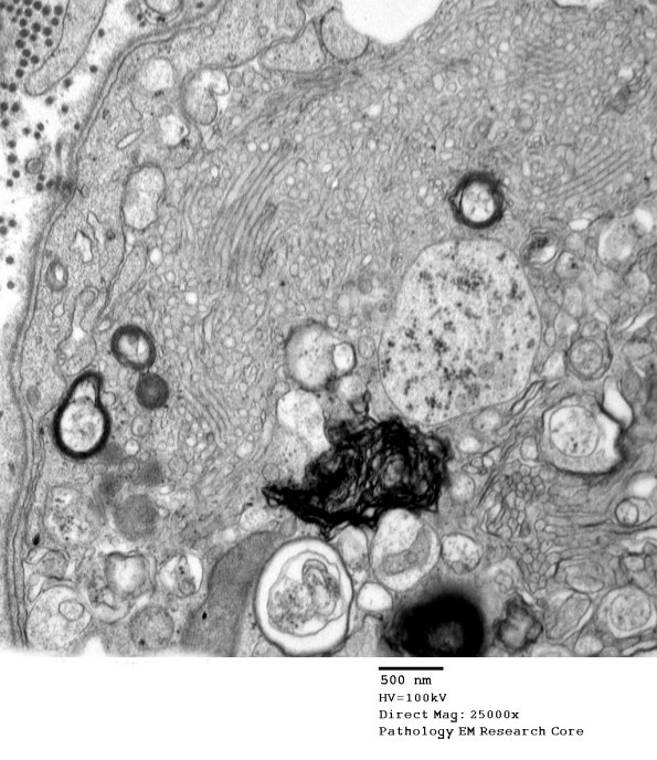 2C14 (Case 10) EM 138 - Copy