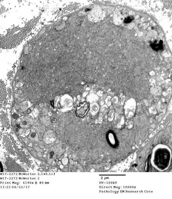 2C15 (Case 10) EM 140 - Copy
