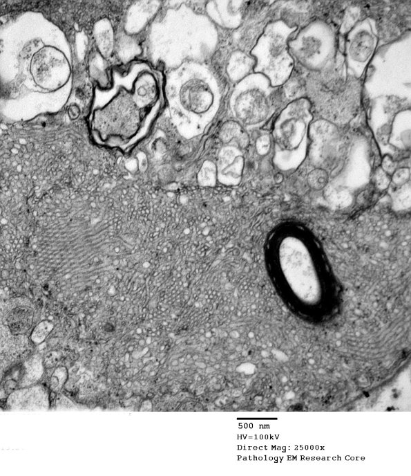 2C16 (Case 10) EM 141 - Copy