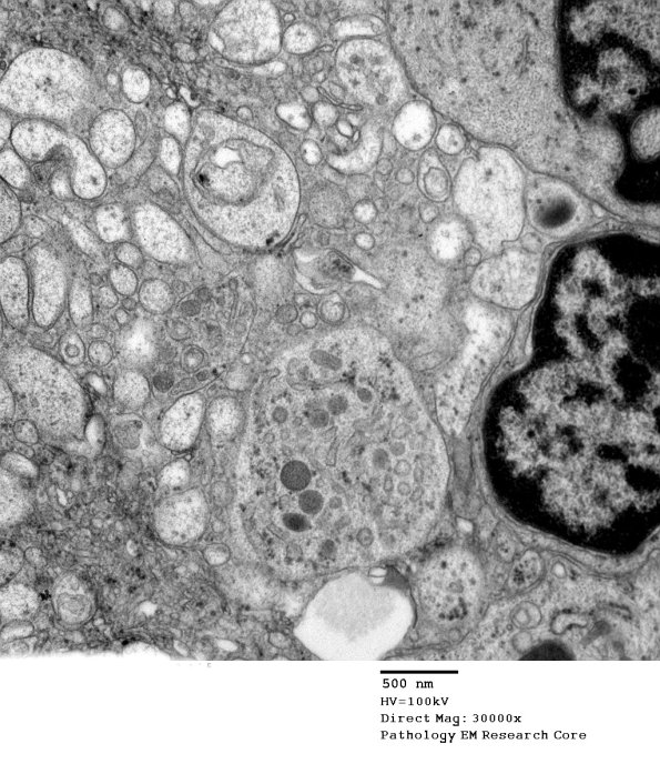 2C2 (Case 10) EM 049 - Copy