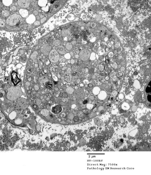 2C3 (Case 10) EM 055 - Copy