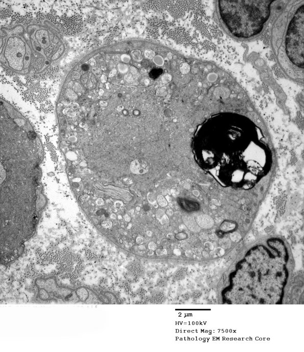 2C6 (Case 10) EM 179 - Copy
