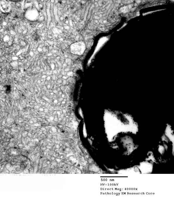 2C7 (Case 10) EM 182 - Copy