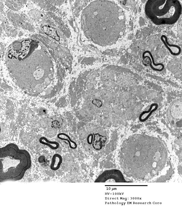 2C8 (Case 10) EM 024 - Copy