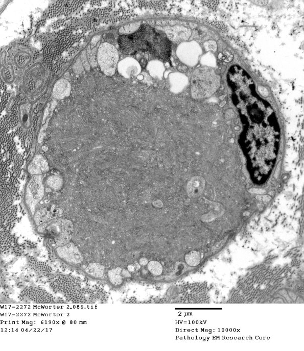 2C9 (Case 10) EM 086 - Copy