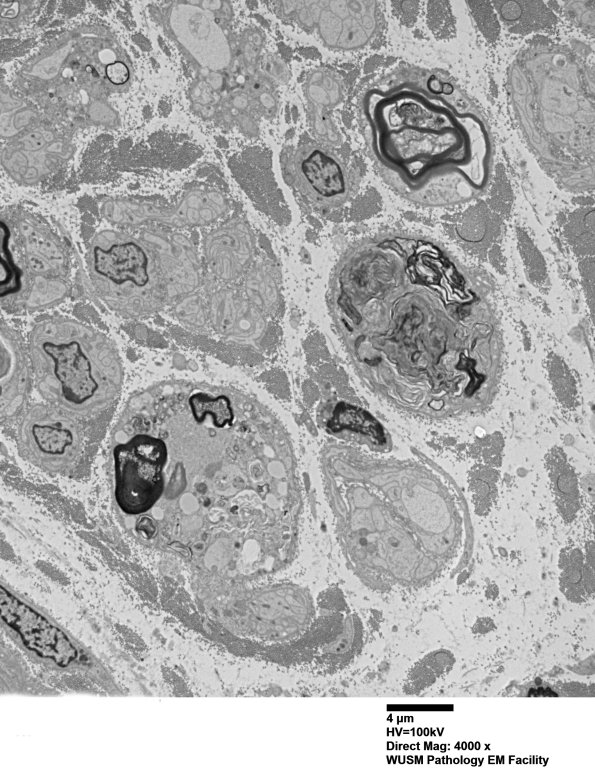 2F1 (Case 13) EM 041 - Copy