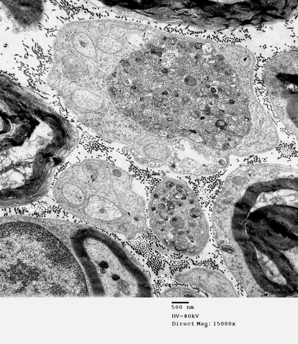 3B1 AMPK KO Mouse Degen Axons_005.jpg