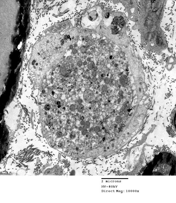 3B2 AMPK KO Mouse Degen Axons_031.jpg