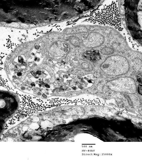 3B4 AMPK KO Mouse Degen Axons_004.jpg