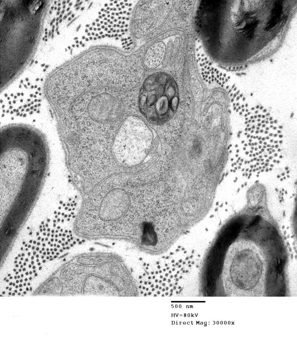 3B5 AMPK KO Mouse Degen Axons_022.jpg