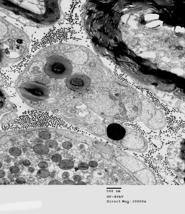3B6 AMPK KO Mouse Degen Axons_002.jpg