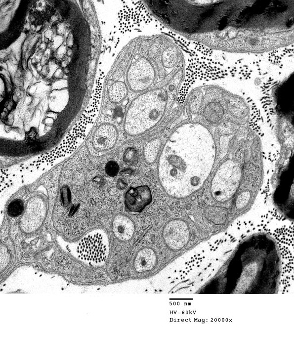 3B7 AMPK KO Mouse Degen Axons_018.jpg