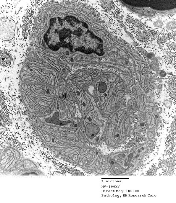 4B1 (Case 15) EM 015 - Copy