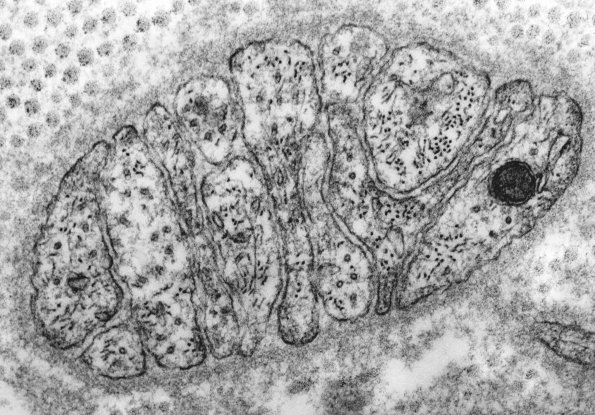 4D2 Unmyelinated stacked processes - Unmyel Band of Bungner 30,000 - Copy